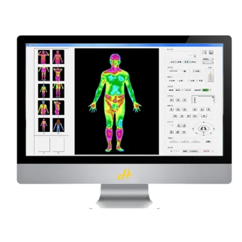 Image Acquisition TMI-S